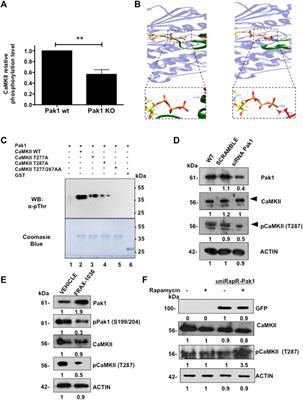 p21-Activated Kinase 1 Promotes Breast Tumorigenesis via Phosphorylation and Activation of the Calcium/Calmodulin-Dependent Protein Kinase II
